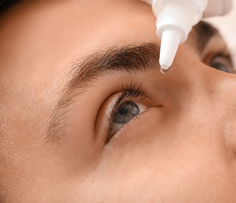 Dry Eye Treatment  Finch Avenue Optometry